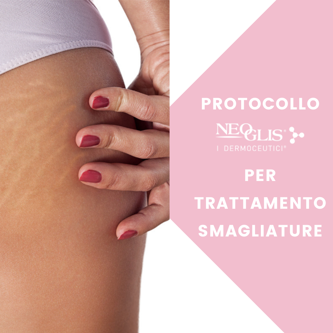 come-si-eliminano-le-smagliature-prodotti-neoglis